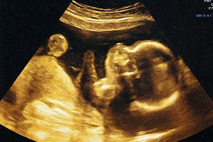 Biden Declares War on the Unborn Four Days After Trump Declares Sanctity of Life Day