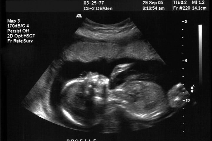 South Dakota and South Carolina Vow to Protect the Unborn