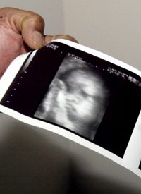 Smiling Fetus Captured in Photograph