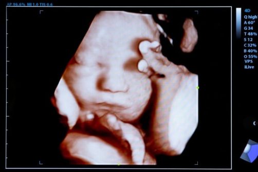 Report: HHS Funded Organ-harvesting Projects from Viable, Full-term Babies