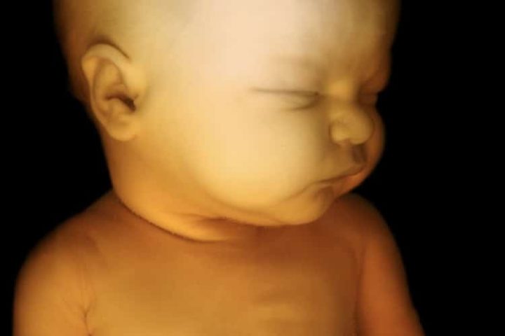 Pure EVIL: FDA Purchased Baby Heads and Body Parts, Demanded “Fresh and Never Frozen”