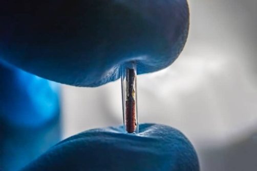 Implantable Chips for Humans Coming “Whether We Like It or Not”