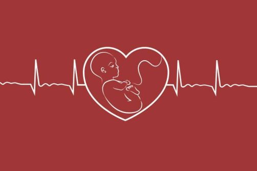 Texas Supreme Court Deals Fatal Blow to Opponents of the State’s Heartbeat Law