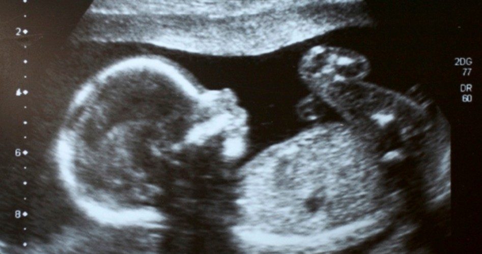 Ontario Official: Catholic Schools Can’t Teach “Misogynistic” Pro-life