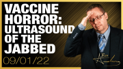 Vaccine Horror: Ultrasound of What The Jab Can Do To Pregnant Women