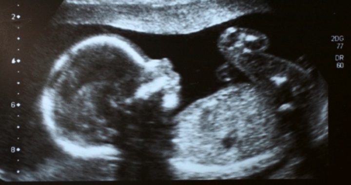 North Dakota Governor Signs “Fetal Pain” Abortion Restriction
