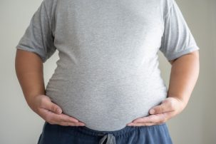 American Medical Association: Body Mass Index Is Racist