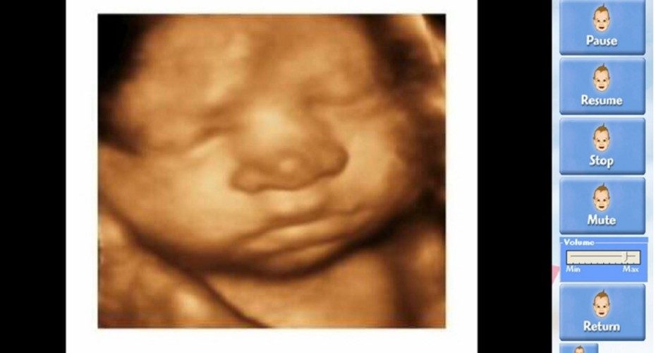 Supreme Court Won’t Hear Case on Oklahoma Ultrasound Law