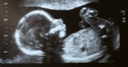 Indiana Acts to Protect the Sanctity of Life