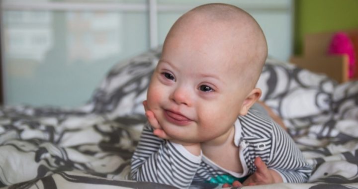 Nearly 100 Percent of Icelandic Mothers Abort Down Syndrome Babies