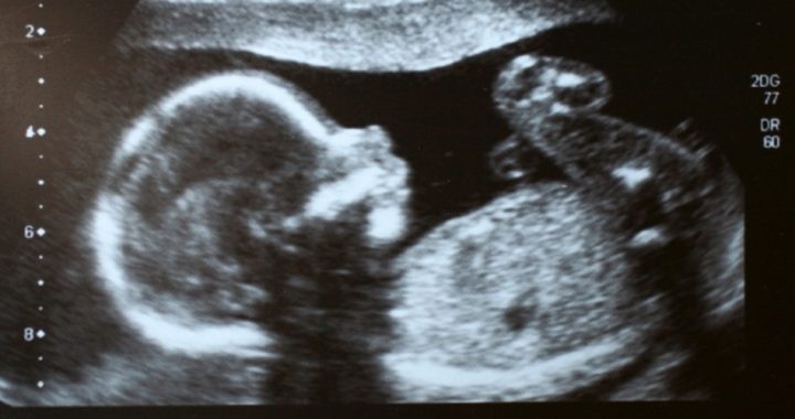 U.S. House Passes Pain-Capable Unborn Protection Act