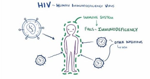 California Law Reduces to a Misdemeanor Intentional Transmission of HIV