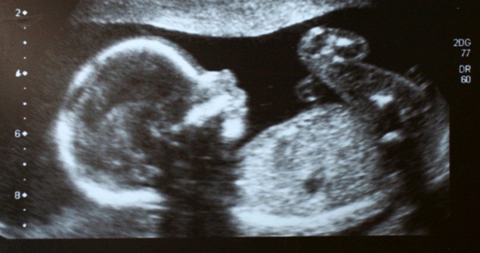 “Pro-Choice” Groups: Doctors Should Have No Choice but to Perform Abortions