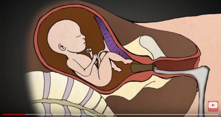 YouTube Removes Pro-life Titles From Top “Abortion” Video Searches