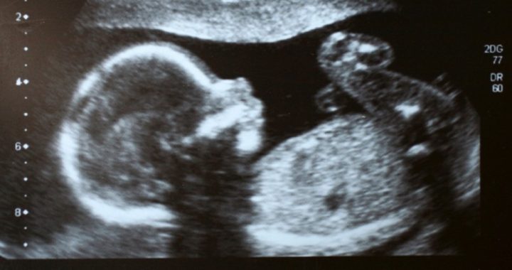 Missouri Introduces Pro-life Parental-notification Abortion Legislation