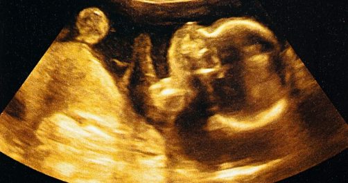 Roswell: First Known for Aliens, Now a Sanctuary for Unborn Babies