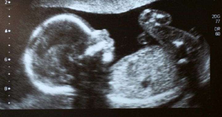 Senate Democrats Block Pain Capable Unborn Child Protection Act
