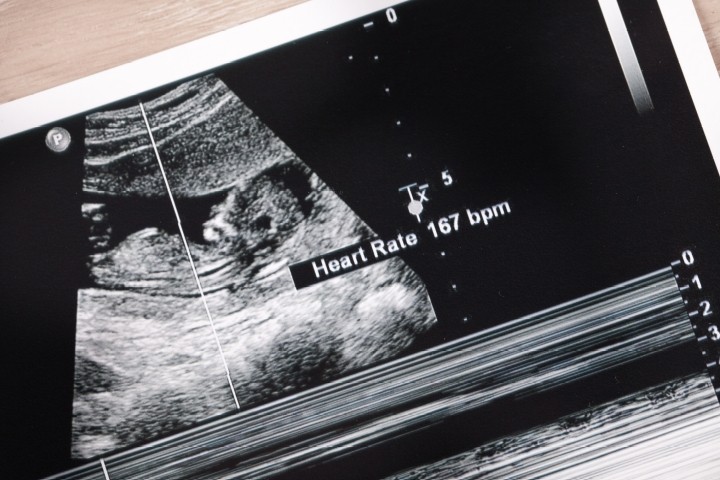 Fetal Heartbeat Bill Close to Becoming Law in Texas - The New American