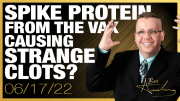 Are Nanoparticles or Spike Protein From The Vaccine Causing These Strange Clots?
