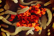 FOIA Docs: NIH Held Meetings With Wuhan Lab Scientists to Discuss Coronavirus Experiments