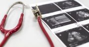 Obama Judge Delays Arkansas’ Anti-abortion law, Hastening Supreme Court Review of Roe v. Wade