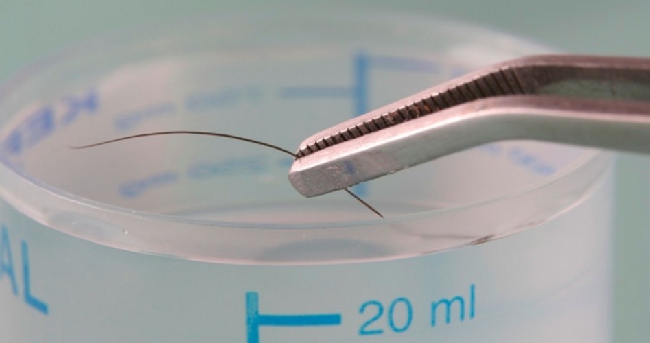 Expert testimony hearsay image